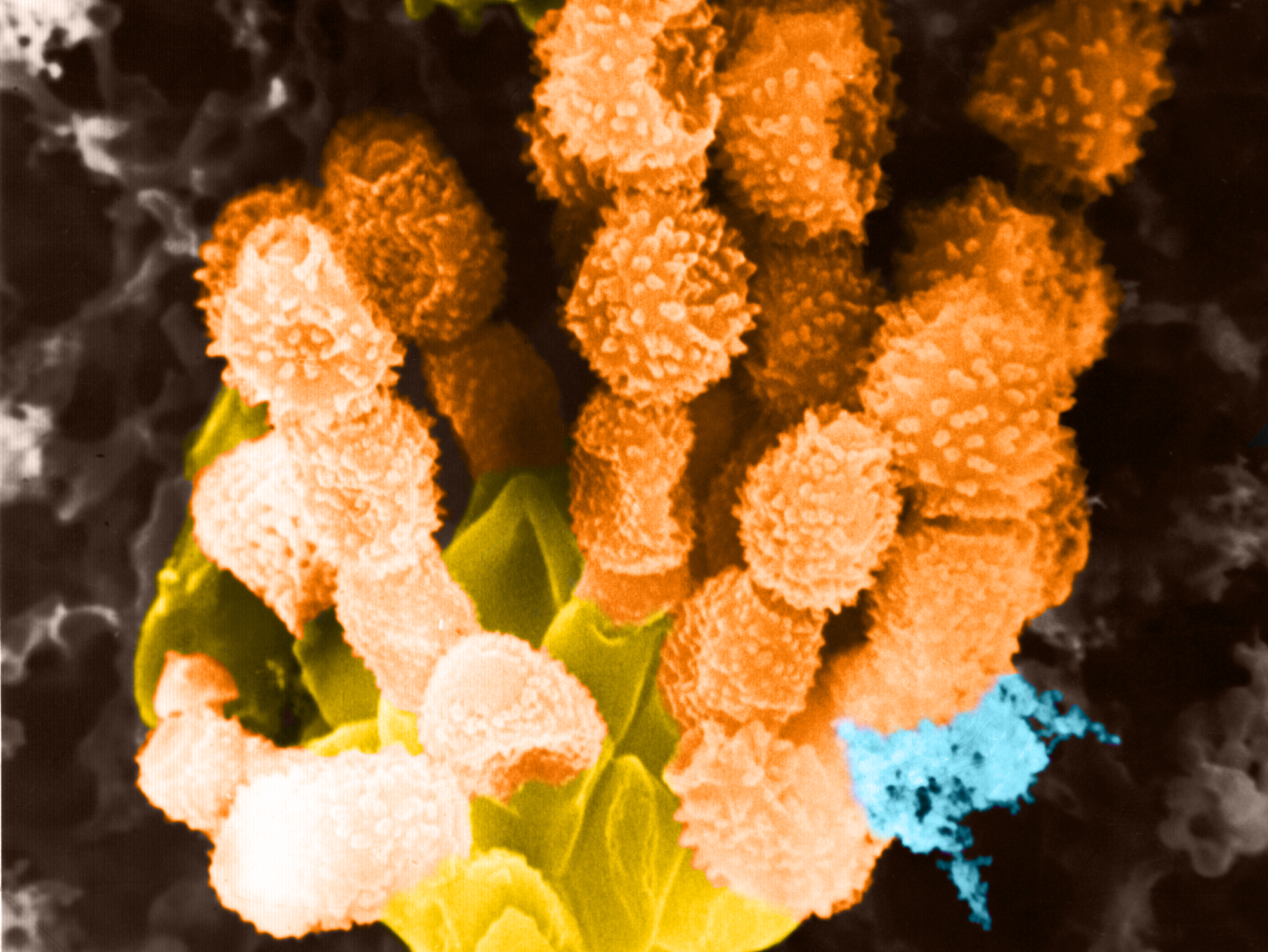 Bioaerosole im Kuhstall: Fruchtstand eines Schimmelpilzes der Gattung Penicillium. Ein Schimmelpilzes der Gattung Penicillium unter dem Rasterelektronenmikroskop