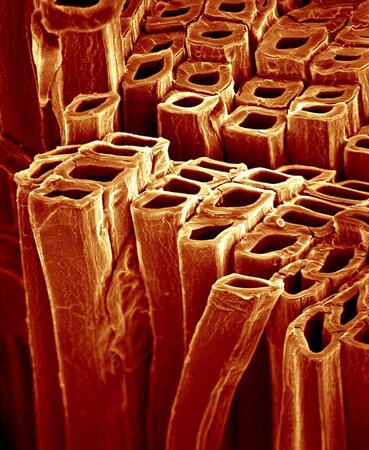 Klicken für eine Vergrösserung Delignifizierte Holzfasern