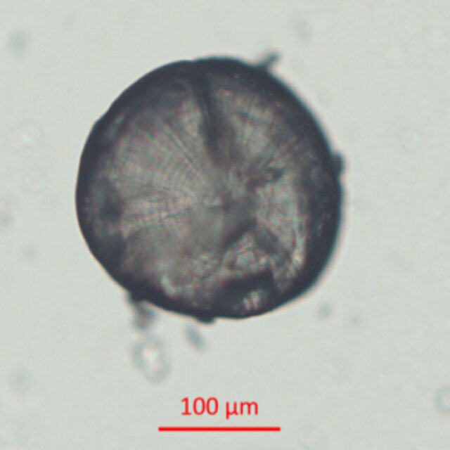Ein Otolith einer Heringslarve mit deutlich sichtbaren Tagesringen. Ein kleiner schwarzgrauer Kreis mit Linien und dem Durchmesser von ca. 200 Mikrometer.