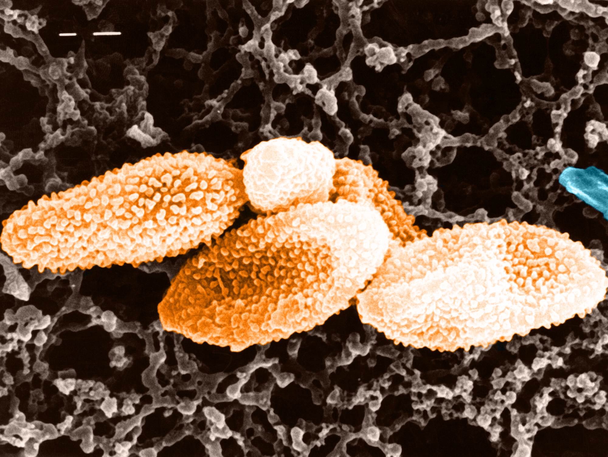 Kleines Aggregat aus Schimmelpilzsporen, bei der Ernte von Weizen gesammelt. Schimmelpilzsporen unter dem Rasterelektronenmikroskop