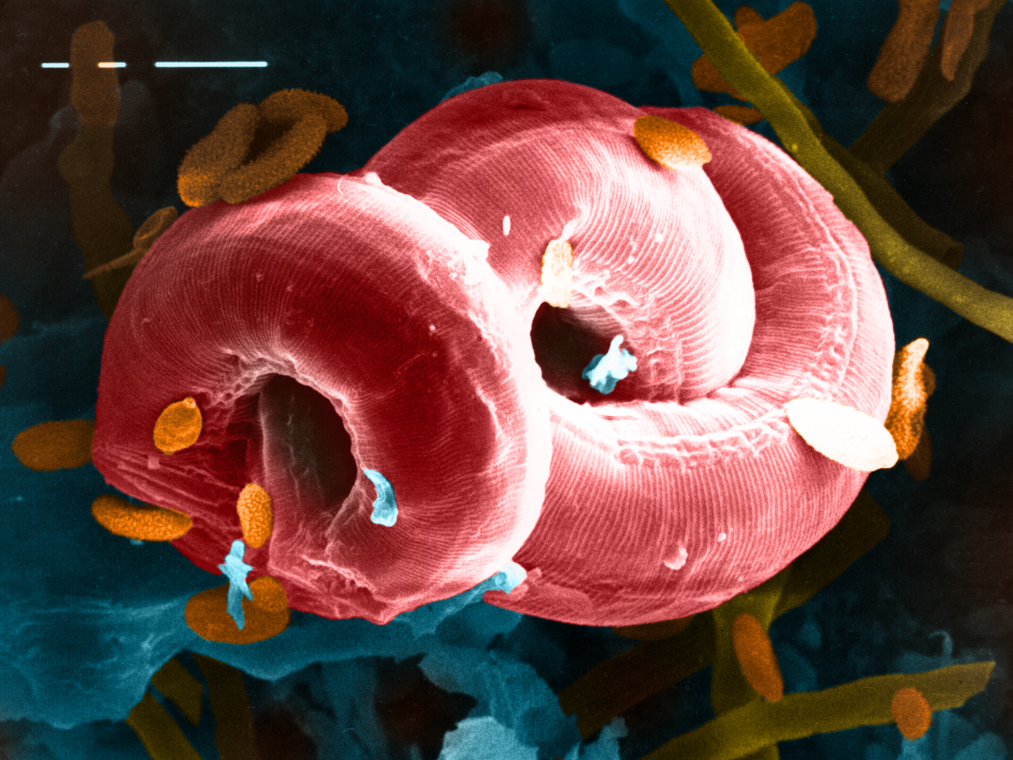 Nematode, bei der Ernte von Weizen gesammelt. Nematode unter dem Rasterelektronenmikroskop