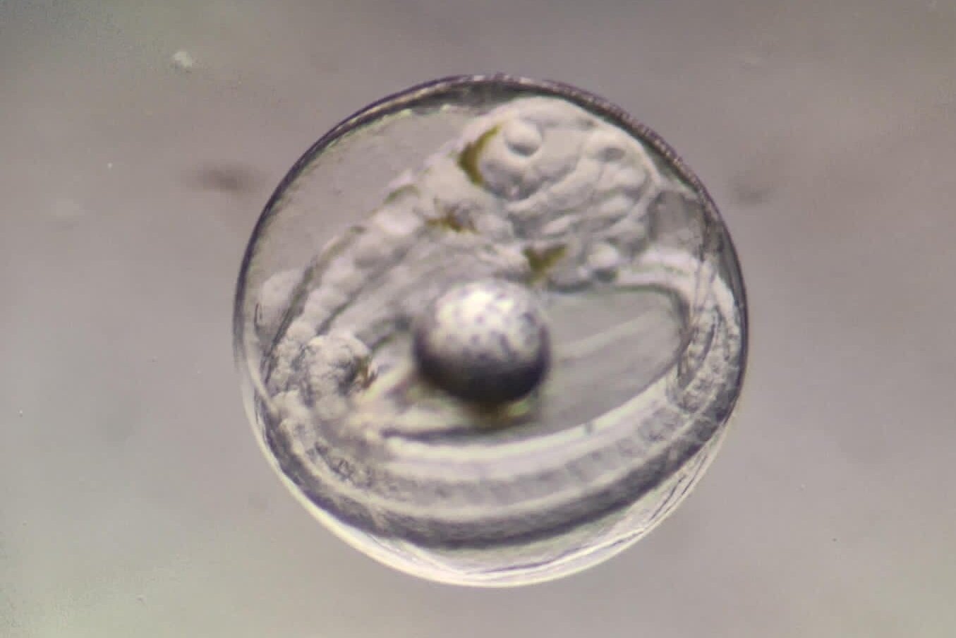 Das Osterei: Makrelenei kurz vor Schlupf. Mikroskopische Aufnahme eines Makreleneis, mit schlüpfbereiter Fischlarve.