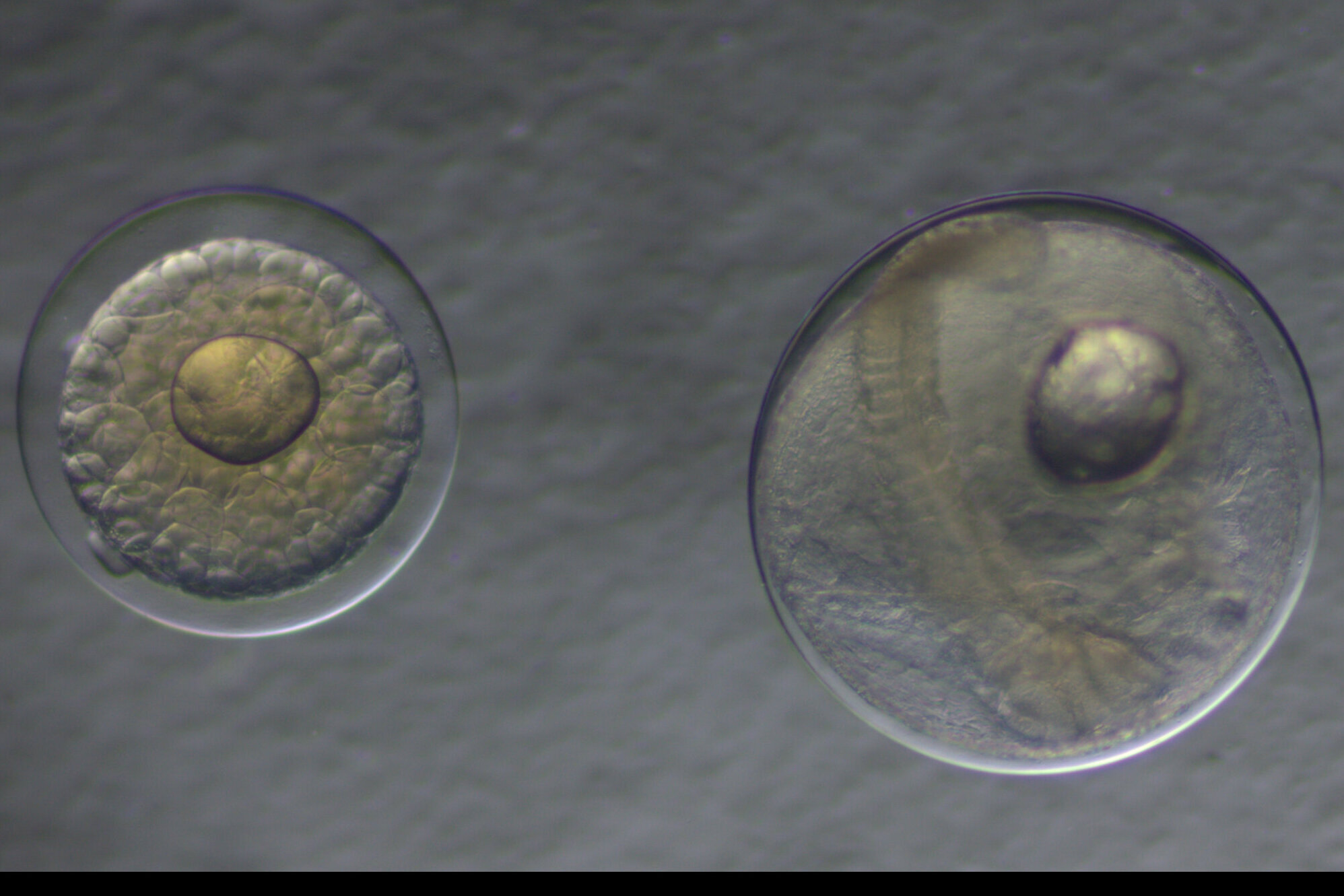 Danach suchen wir: Makrelen- und die kleineren Stöckereier. Microscopic image of fish eggs.