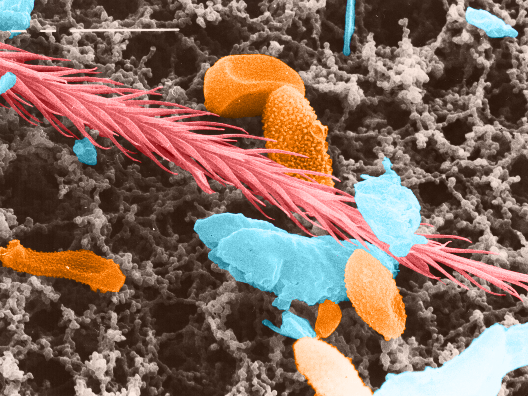 Tasthaar eines Käfers und verschiedene Schimmelpilzsporen. Tasthaar eines Käfers und verschiedene Schimmelpilzsporen unter dem Rasterelektronenmikroskop