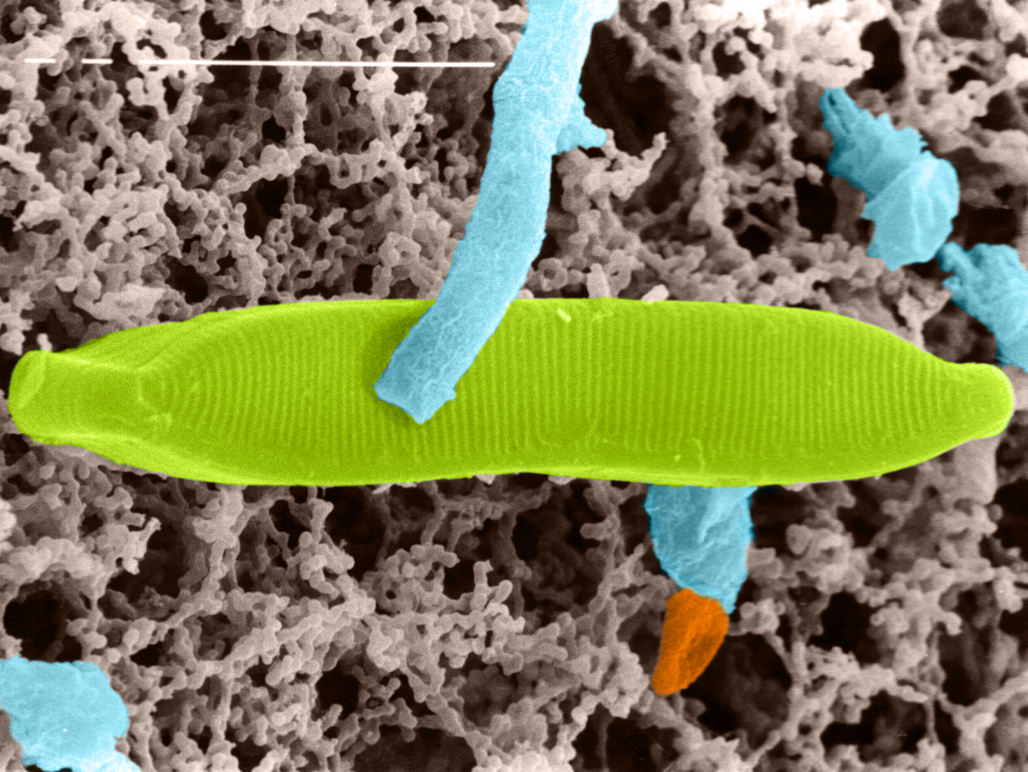 Kieselalge, bei der Ernte von Gerste aus der Luft gesammelt. Kieselalge unter dem Rasterelektronenmikroskop